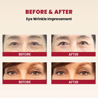 Seoul 1988 Retinal Serum™ Liposome 2% + Black Ginseng